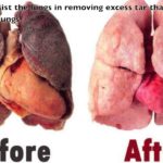 දුම්පානය සෞඛ්යට බලපාන්නේ කෙසේද? (How Does Smoking Affect Health?)