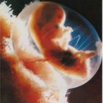 චර්මච්ඡේදනය කරන්නේ ඇයි? (Why circumcision is doing?)